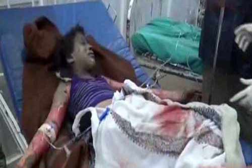 &rsquo;الحزم&rsquo; السعودي يحوّل أطفال اليمن إلى أشلاء