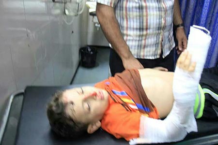 طفل يتلقى العلاج بعد اصابته بقصف اسرائيلي اليوم الـ18 للعدوان يبدأ بمجزرتين جديدتين