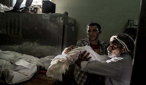 جثمان احد االطفال في مشافي غزة تهدئة لـ72 ساعة في غزة ابتداء من صباح الثلاثاء