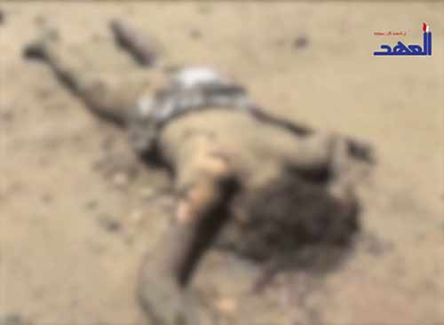 مشاهد وصور مروعة للمجازر السعودية في اليمن - يرجى عدم المشاهدة  لاصحاب القلوب الضعيفة