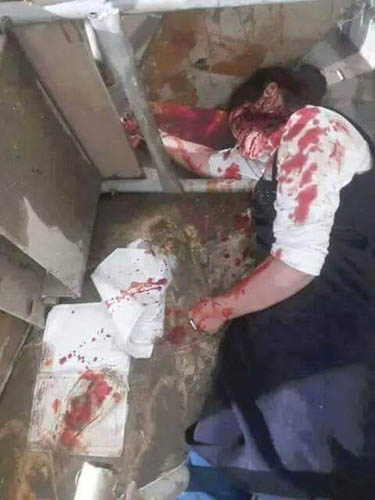 مجازر جديدة بحق اليمنيين غالبية ضحاياها من الأطفال والنساء