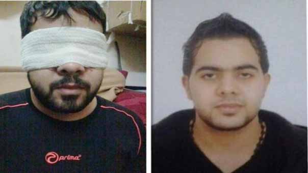 البحرين: معتقل سياسي يفقد بصره بسبب الإهمال المتعمّد من قبل السلطات 