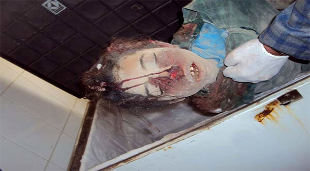 استشهاد 3 طلاب يمنيين وإصابة آخرين بقصف سعودي
