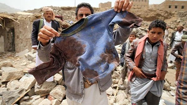 منظمات حقوق الإنسان تدعو الأمم المتحدة للتحقيق في انتهاكات السعودية في اليمن