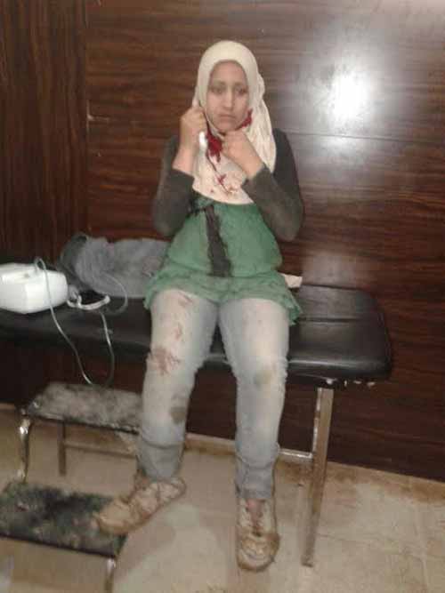 بالصور.. أطفالٌ شهداء في كفريا والفوعة أمام مرأى الأمم المتحدة