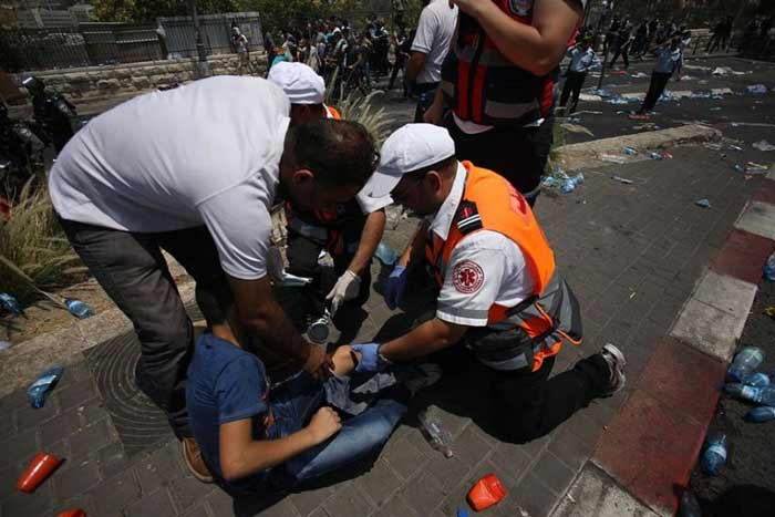 بالصور: شهداء وأكثر من 390 إصابة باعتداءات صهيونية على مظاهرات الفلسطينيين نصرة للأقصى