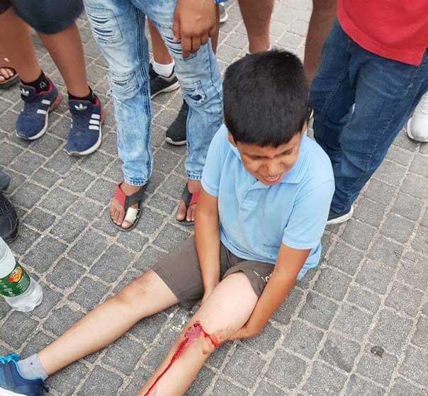 مستوطن يدهس 4 أطفال فلسطينيين في بلدة سلوان بالقدس المحتلّة