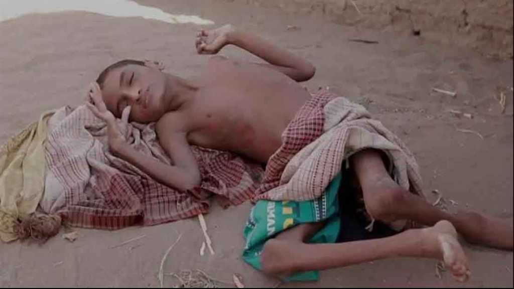 الجوع قاتل اليمن الصّامِت