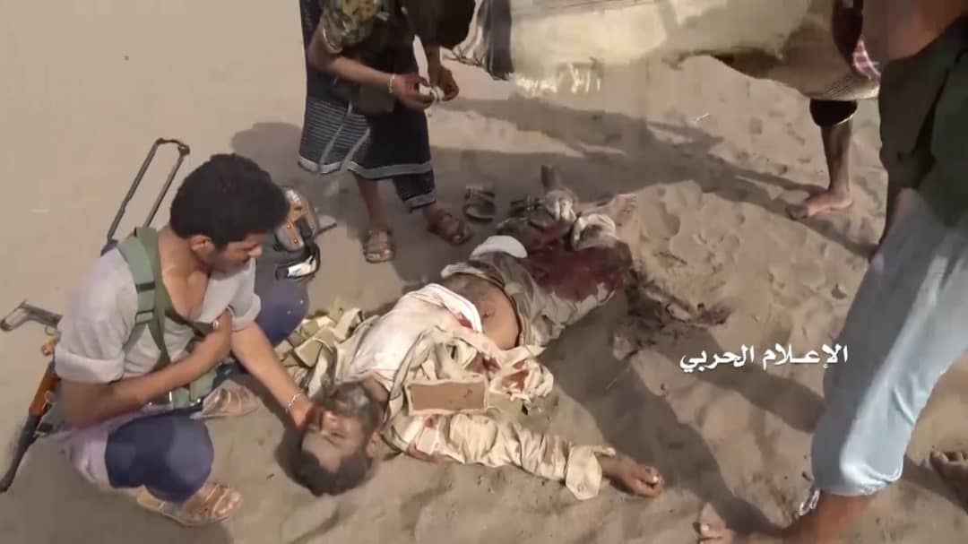 بالصور: كتيبة كاملة لمرتزقة العدوان بين قتيل وجريح وأسير في الساحل الغربي