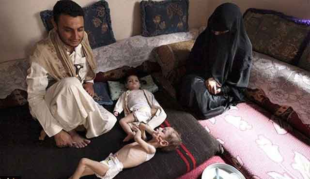 الجوع قاتل اليمن الصّامِت