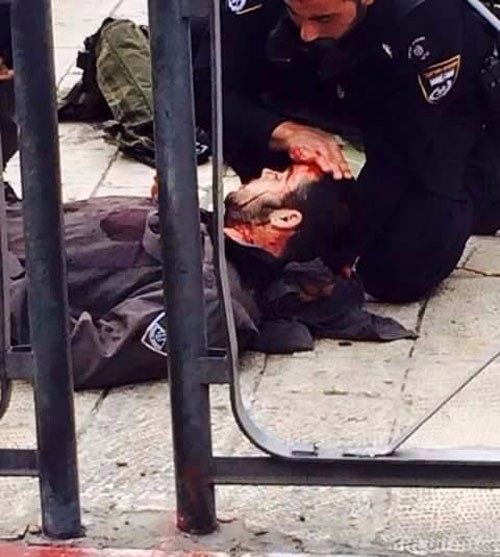 شرطي صهيوني بعد اصابته خلال عملية الطعن في القدس المحتلة استشهاد شاب فلسطيني بعد طعنه شرطيين صهيونيين قرب باب العامود في القدس المحتلة