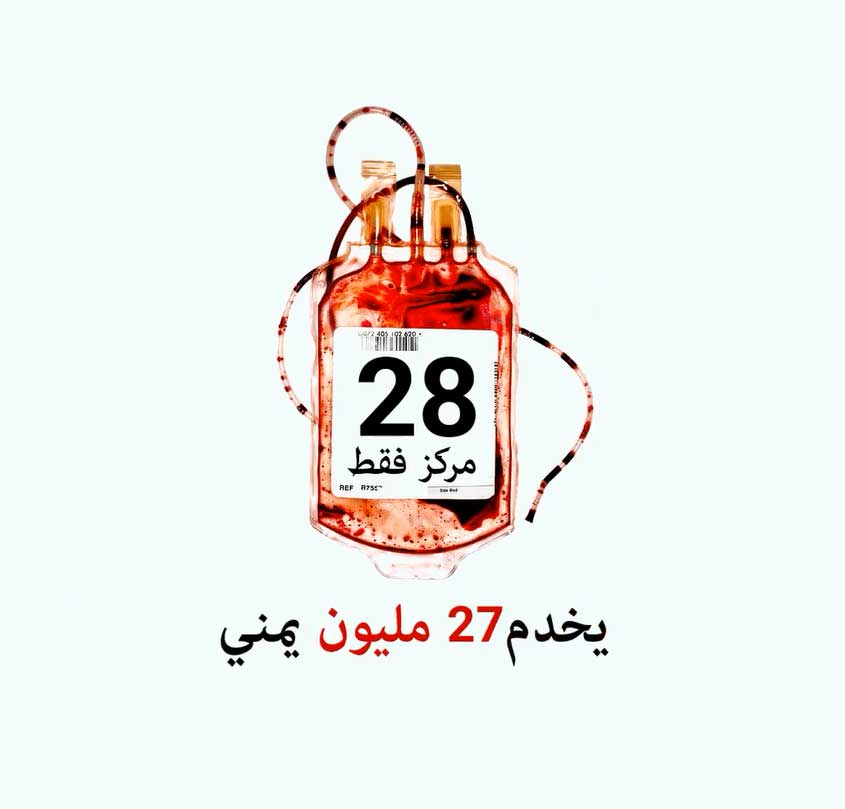 مرضى الكلى.. يموتون في اليمن بسبب العدوان السعودي ـ الاميركي